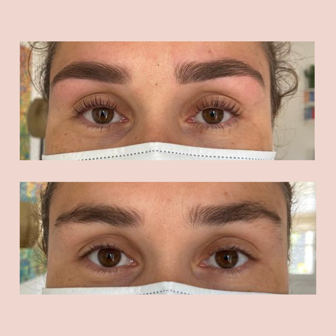 Site format post sourcils browlift